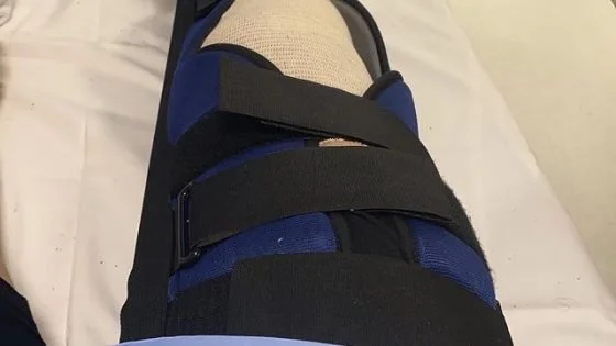Jared Graves injury